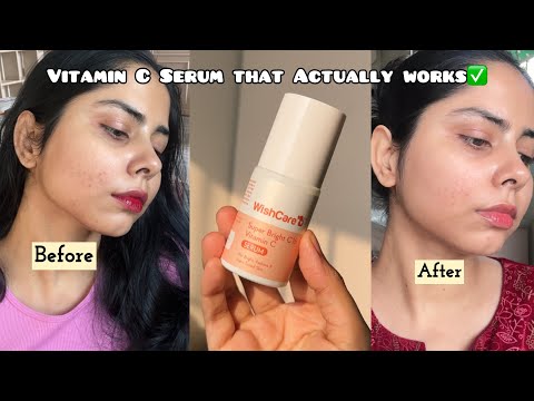 Detailed review of new launch WishCare Super Bright C16 Vitamin C serum | After trying for 1 month