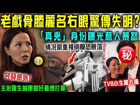 突發意外！ 「陀槍師姐」滕麗名右眼被誤傷，已經緊急趕往醫院搶救！主治醫生喊爆做好最壞打算，視網膜90 % 會脫落！ 「真兇」身份一言難盡！【星娛樂】 #滕麗名 #失明 #視網膜 #拍戲 #袁文傑