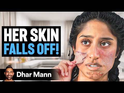 Girl Whose SKIN FALLS OFF! | Dhar Mann Studios