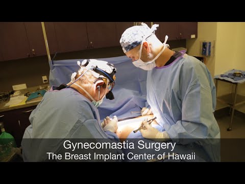 Honolulu Gynecomastia Surgery (Graphic) - Part Three - Gland Removal - Gynecomastia Hawaii