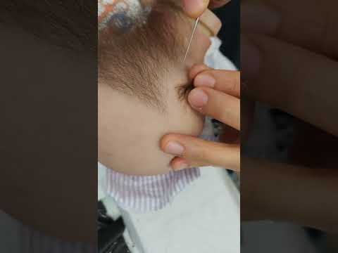 Live Highlight: Reborn Rooting