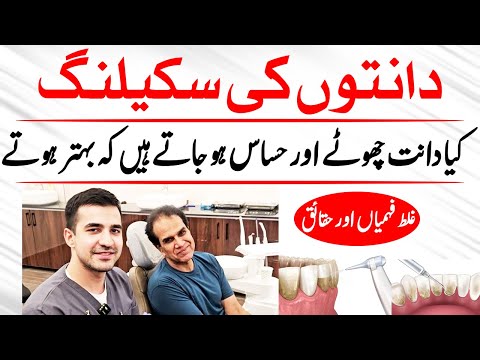 Scaling Se Darna Chahiye Ya Nahi? | FT: Dr Muhammad Ali Nadeem | Healthy LifeStyle by Shahzad Basra