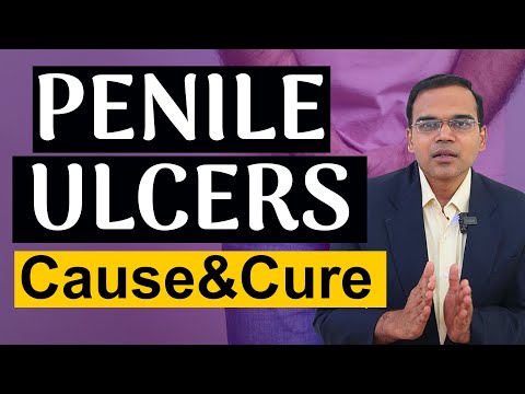 "Penile Ulcers Explained: Causes, Symptoms & Treatment in tamil 🩺 | Don't Ignore These Signs!"