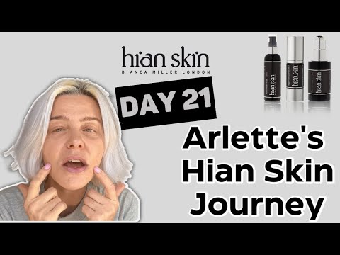Arlette's Hian Skin Journey Day 21: Fresh & More Even Skin Tone - Hian Skin - Bianca Miller London