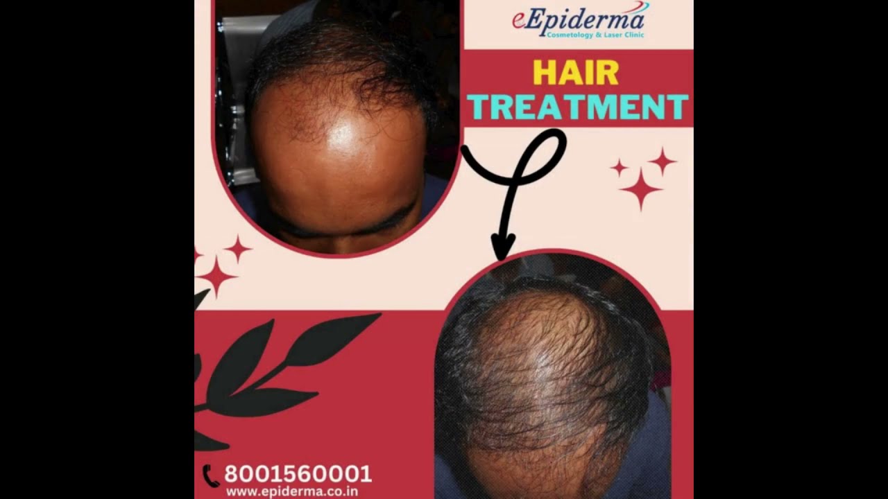 Social 1 Best Skin Specialist and Laser Treatment Clinic in Durgapur