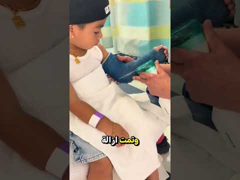 الولد يخاف من منشار الجبس 😨 لكن رد فعل الطبيب كان غير متوقع! 🤯 | لحظة مضحكة ومريحة ❤️