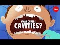 Understanding Cavities and Oral Health