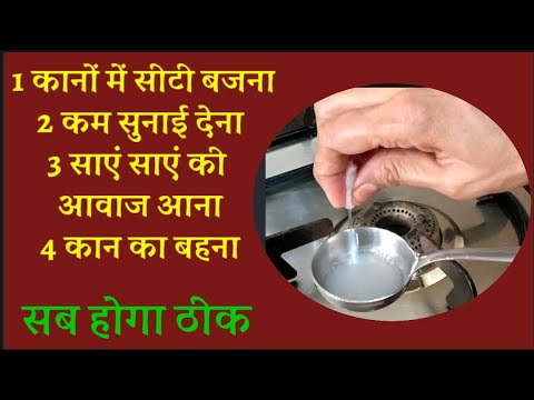 कानों में सीटी बजना,कानों में साएं साएं की आवाज आना कानों में भारीपन,कम सुनाई देना सभी के लिए कारगर
