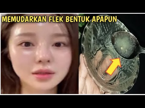 Lakukan Trik Ini!! Cuma Oles 30 Menit Semua Bentuk Flek Hitam yanga Ada Pada Wajah Hilang Total