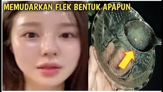 Lakukan Trik Ini!! Cuma Oles 30 Menit Semua Bentuk Flek Hitam yanga Ada Pada Wajah Hilang Total