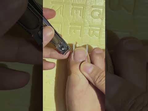 L’astuce invisible pour soigner un ongle incarné