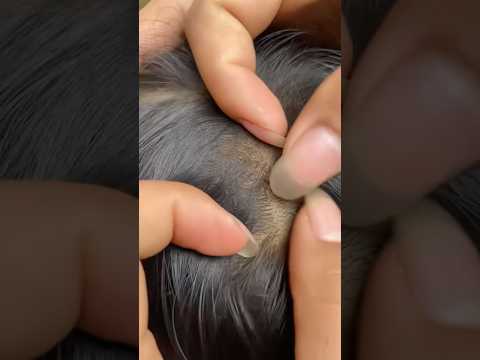Piolho gosta de cabelo limpo??? #cabelo #cabelocacheado #cachos #cacheada #shortsvideo #cabelos