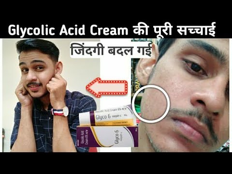 Glyco 6 cream & Glyco 12 cream l glycolic acid | remove Pigmentation | acne scars | pimple mark