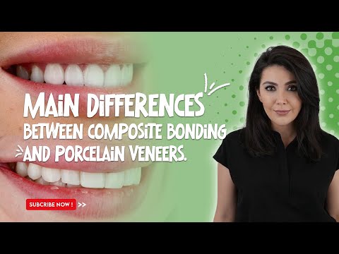 Composite Bonding or Porcelain Veneers