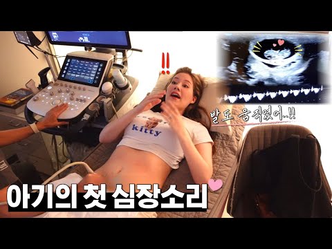 아기의 첫 심장소리를 듣고 감격한 미국인 아내..! 손이랑 발도 움직임💕