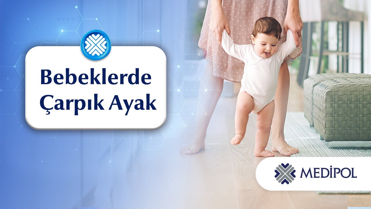 Bebeklerde Çarpık Ayak Teşhis ve Tedavisi