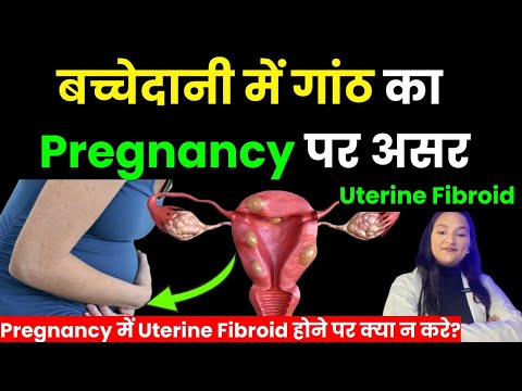 Fibroid का प्रेग्नेंसी पर असर | प्रेग्नेंसी में बच्चेदानी में गांठें है तो किन बातों का ध्यान रखें?