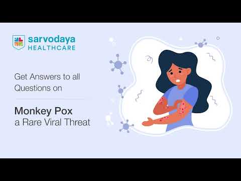 Monkey Pox: A Rare Viral Threat