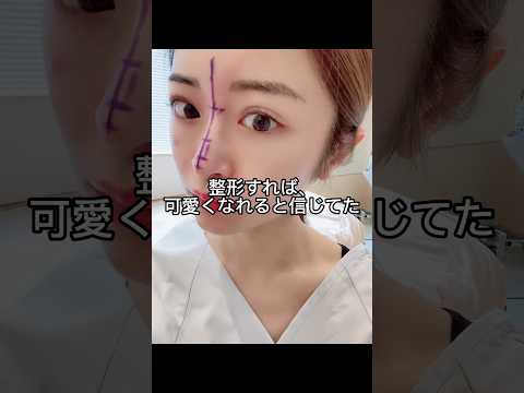 整形すれば可愛くなれると信じてた。#美容整形 #美容 #整形 #スキンケア #コスメ