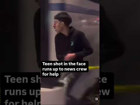 His Adrenaline is prolly what saved him 😮