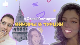 Решилась на ВИНИРЫ 😱 в Турции! (мой опыт, все тонкости)
