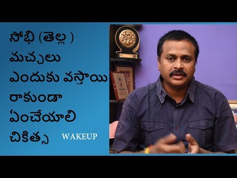 #TINEAVERSICOLOR FUNGAL SYMPTOMS AND TREATMENT IN TELUGU|HOMEOPATHY@WAKEUP