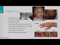 Exploring Diseases and Disorders of the Integumentary System
