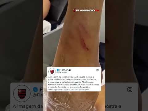 FLAMENGO NA BRONCA! 🔴⚫ O Rubro-Negro reclamou da falta de punição da arbitragem #shorts