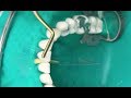 Dental Tools and Procedures Assessment