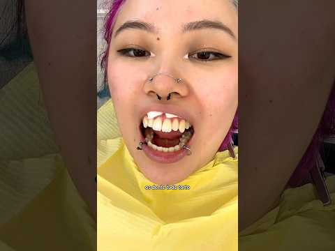 Coloquei presas de vampiro permanentes!🧛🏻♀️🩸 @ dradeboramarchetti #vampire