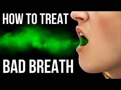 How to treat and prevent BAD BREATH | A Doctor's guide