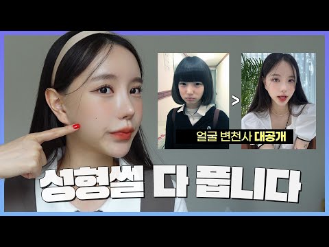이 수술은 절대 하지마세요😤!!내가 여태껏 받은 성형수술의 모든것/눈,코,안면윤곽 수술후기, 부작용,회복기간 등등...(ENG/JPN)
