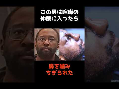 ニュースの動画サムネイル - 【喧嘩の仲裁に入ったら鼻を噛みちぎられた男】 #shorts #事件解説 #仰天