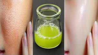 3 Days Challenge Super Glossy Skin Tightening Toner After 2 Use Visible Spotless Glowing Skin