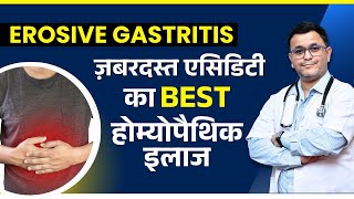 3 BEST homeopathic medicine for gas and acidity EROSIVE GASTRITIS
