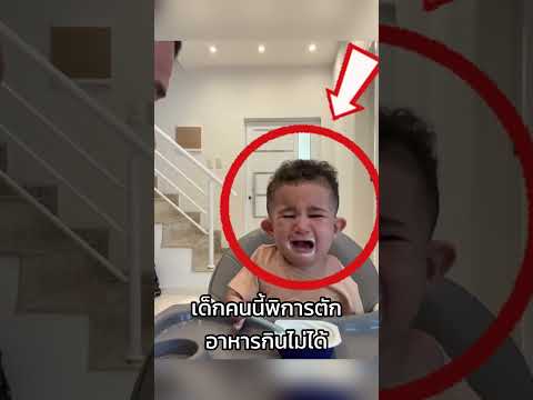 เด็กคนนี้พิการตักอาหารกินไม่ได้