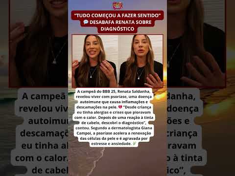 Ex-BBB Renata Saldanha revela doença autoimune e emociona fãs 💔