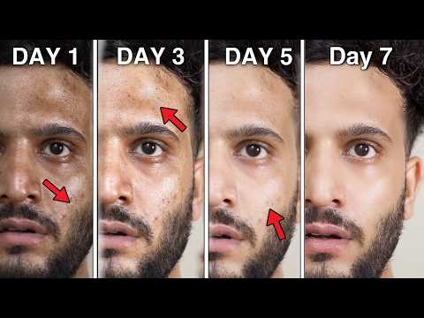 Remove Tanning[10X Glow on Your Skin]|Tips For Naturally Glowing Skin & Home Remedy