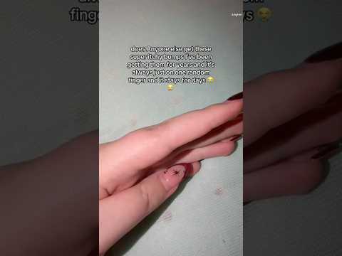 Does anyone else get these itch bumps? ๐ญ#help #nails #nailtech #relatable