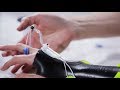 Creating and Using a Dorsal Wrist Orthosis