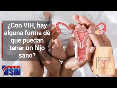 Si el hombre es VIH positivo y la mujer sana. ¿Hay alguna forma de que puedan tener un hijo sano?