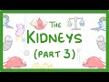 Kidney Failure Treatment and Management