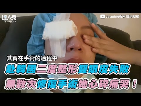 【赴韓國二度整形雙眼皮失敗 無數次修復手術她心碎痛哭！】｜@Jasmine香米