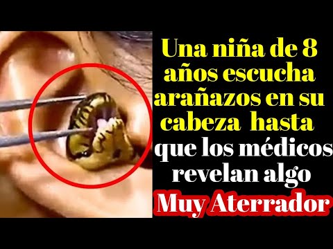 Niña de 8 años escucha arañazos en su cabeza! El médico queda aterrado al ver que había en ella.