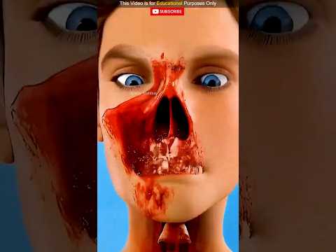 Stop Doing This When Your Nose Bleeds! 😱
