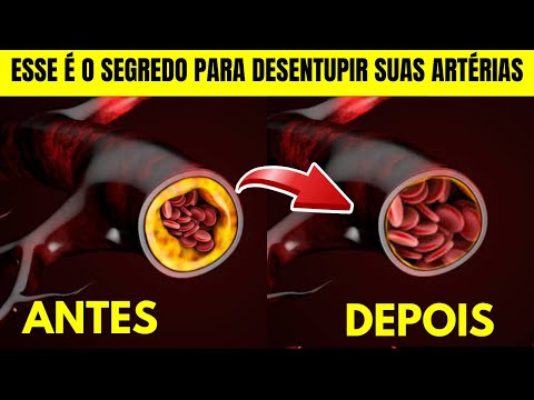 3 SEGREDOS PARA DESENTUPIR AS ARTÉRIAS QUE POUCOS SABEM