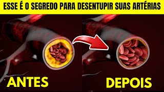 3 SEGREDOS PARA DESENTUPIR AS ARTÉRIAS QUE POUCOS SABEM