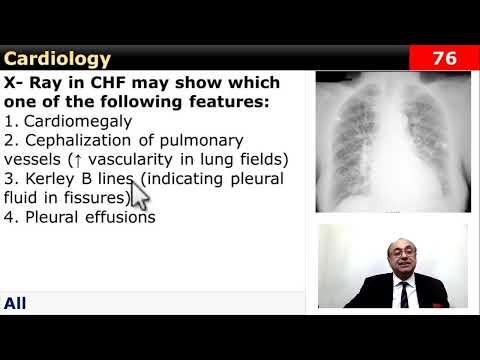 #internal_medicine #cme #usmle #محاضرات_باطنة #ecg #كورسات_باطنة #clinical #clinical #medicine
