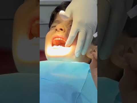 كريم كتير بياكل شوكولا لهيك اخدنا عالطبيب /@aalmolft6427 @Kidskoki #سني_منخور