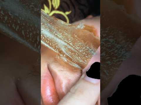 빠진다~🙀#blackheads #blackheadcaique #pimple #모공케어 #여드름 #skincare #피부 #shorts